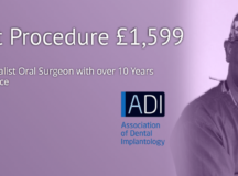 Are Dental Implants Your Best Option?